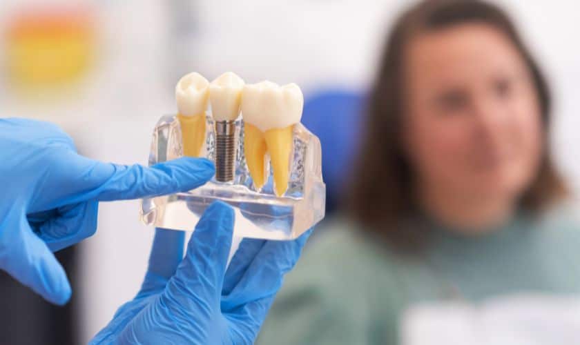 Dental Implants El Paso