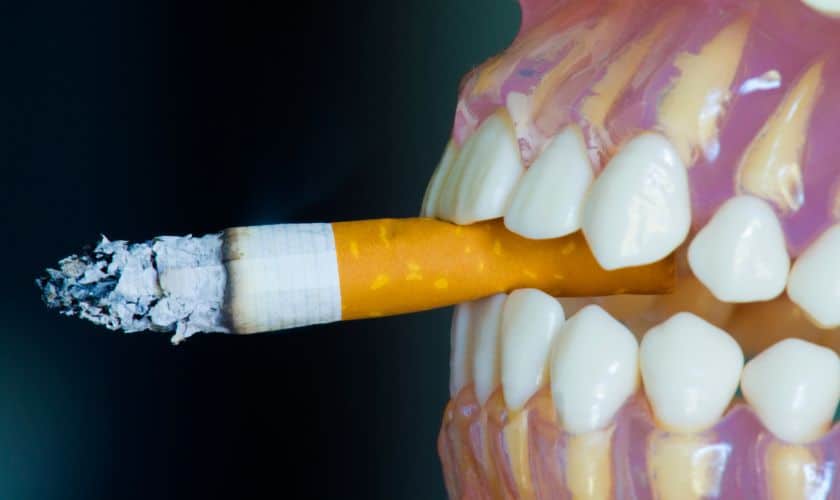 Featured image for “How Smoking Can Impact Teeth Whitening Results?”