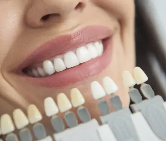 Veneers in El Paso, TX